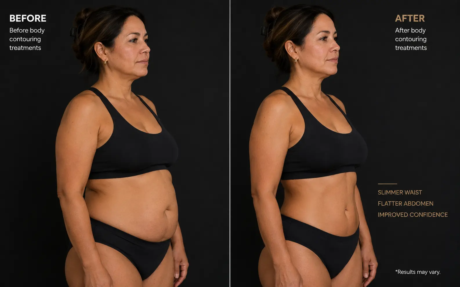 Before-and-after profile comparison of a woman's waist and abdomen showing a smoother contour