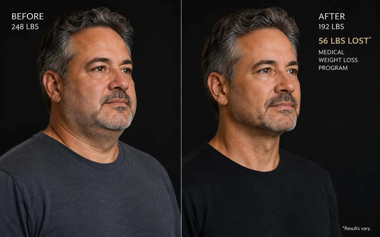 Before-and-after comparison of a man showing a change in facial and neck definition